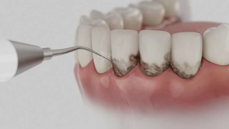 Reliable Teeth Whitening contractor in Montmorency County County, MI by Dentist Open Now
